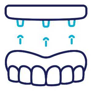 Denture