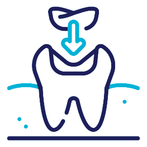 Dental Fillings