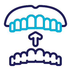 Clear Aligners
