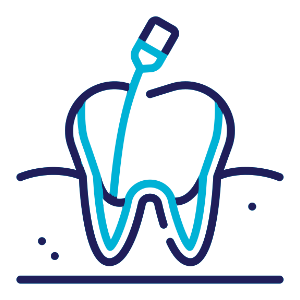 Root Canal Treatment